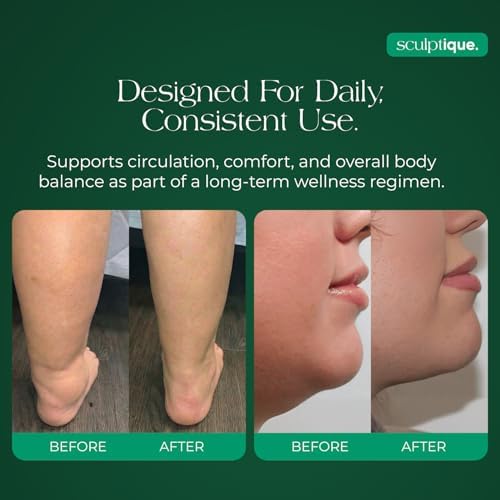 Suplemento de Drenaje Linfático Sculptique – Cápsulas con Diente de León, Bardana, Cleavers y Equinácea, Apoya la Inflamación, Balance de Líquidos y - imagen 4