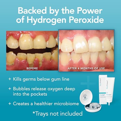 Gel Perio | Tratamiento Periodontal para Dientes | Promueve el Blanqueamiento Dental (85 g) - imagen 8