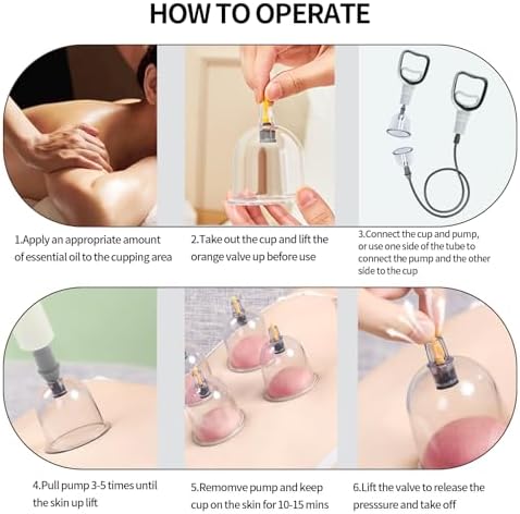 Set de Ventosas Cupluw, Kit de 24 Copas para Terapia de Masaje, Terapia China con Imán, Set Profesional de Ventosas para Reducir Celulitis y Aliviar - imagen 3