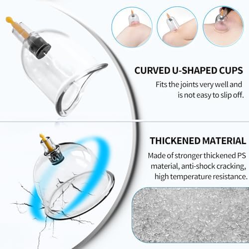 Set de Ventosas Cupluw, Kit de 24 Copas para Terapia de Masaje, Terapia China con Imán, Set Profesional de Ventosas para Reducir Celulitis y Aliviar - imagen 5