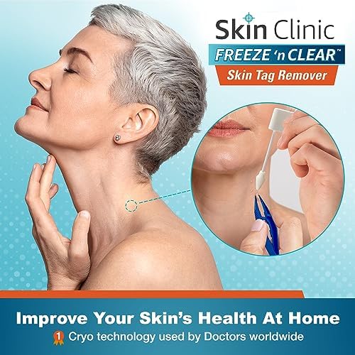 Skin Clinic Freeze 'n Clear Eliminador de Etiquetas de Piel - Kit Criogénico con 8 Aplicadores de Punta Precisa + Pinzas - Solución Aprobada por la - imagen 2