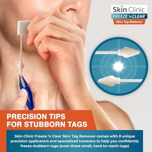 Skin Clinic Freeze 'n Clear Eliminador de Etiquetas de Piel - Kit Criogénico con 8 Aplicadores de Punta Precisa + Pinzas - Solución Aprobada por la - imagen 5