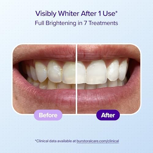 Tiras Blanqueadoras para Dientes Sensibles BURST (Menta) | 20 Tiras/10 Tratamientos – Resultados Visibles en 15 Minutos | Kit Seguro para Esmalte - imagen 3
