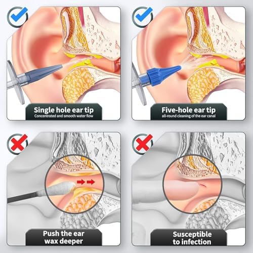 Kit de Limpieza de Oídos, Sistema Manual de Irrigación para Eliminación de Cerumen, Seguro y Efectivo para Limpiar Acumulación de Cera - imagen 4