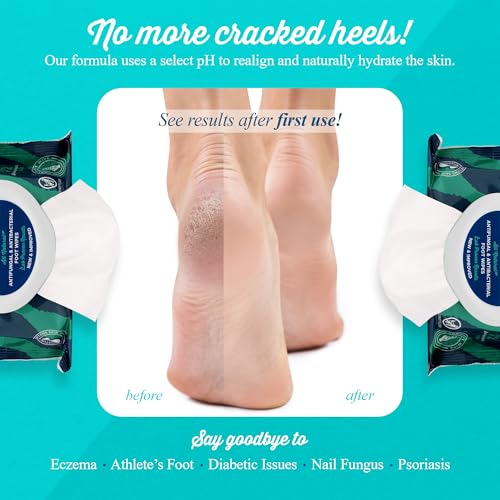 Toallitas para Pies pHeet® - Fórmula Natural Antifúngica y Antibacteriana, Limpia, Hidrata y Previene Hongos en los Pies, 72 piezas - imagen 4