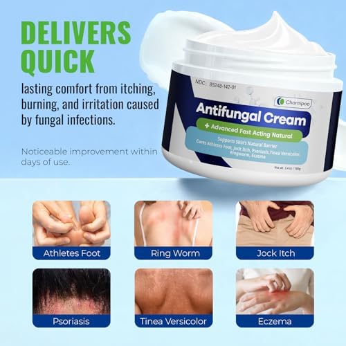 CREMA ANTIFÚNGICA CHARMPOO, 2% Miconazol para Picazón de Ingle, Pie de Atleta y Tiña, 3.4 oz / 100g, Absorción Rápida para Pies, Ingle y Pliegues - imagen 2