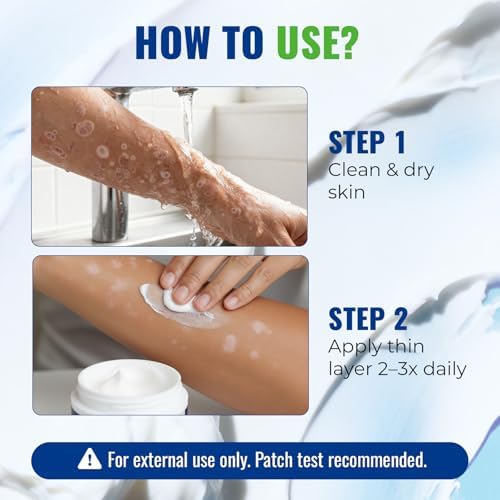 CREMA ANTIFÚNGICA CHARMPOO, 2% Miconazol para Picazón de Ingle, Pie de Atleta y Tiña, 3.4 oz / 100g, Absorción Rápida para Pies, Ingle y Pliegues - imagen 4
