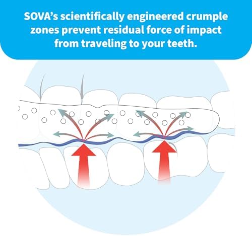Funda para Dientes SOVA Aero - Protector Nocturno Personalizado de 1.6mm - Previene el Bruxismo - Sin Olores ni Sabores - Remoldeable hasta 20 Veces - imagen 5