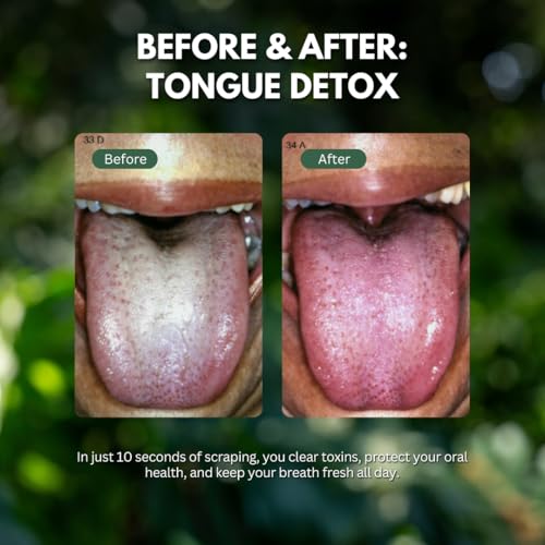 Raspador de Lengua PRIMALS de Cobre - Aliento Fresco y Mejora de la Salud Oral - Limpiador Ayurvédico Natural para Detox Diario - Resistente a la - imagen 6