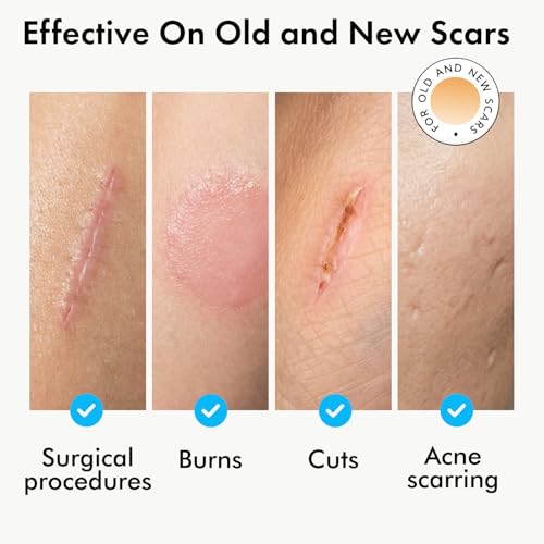 Gel para Cicatrices Serica (30ml), Fórmula Avanzada de Silicona, Ayuda a Lograr una Piel Más Suave Después de Cirugías, Cortes, Quemaduras o Acné, No - imagen 3