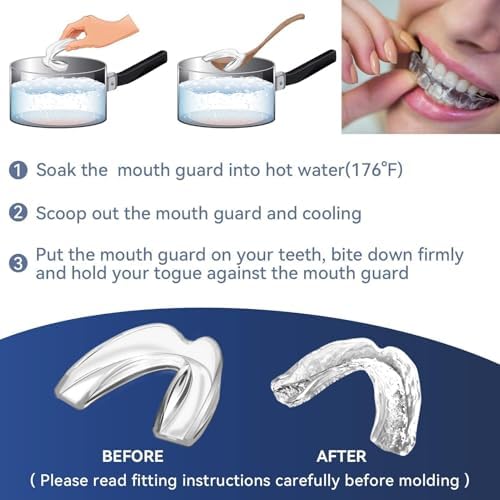 Bokzen Férula Dental Infantil para Bruxismo, Paquete de 8, Guardas Nocturnas Personalizables, Detalles Cómodos, Transparente - imagen 5