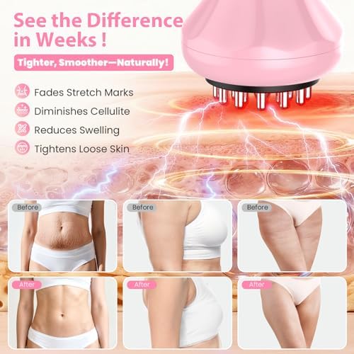 Masajeador de Drenaje Linfático, Herramienta Anticelulitis para Muslos y Abdomen, Reducción de Estrías y Celulitis, Masajeador Manual para Alivio de - imagen 6