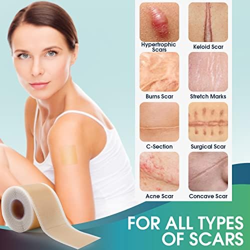 Hojas de Silicona Profesional para Cicatrices (Rollos de 1.6 x 150) - Tratamiento para Remoción de Cicatrices - Cinta Reutilizable para Keloides, - imagen 6