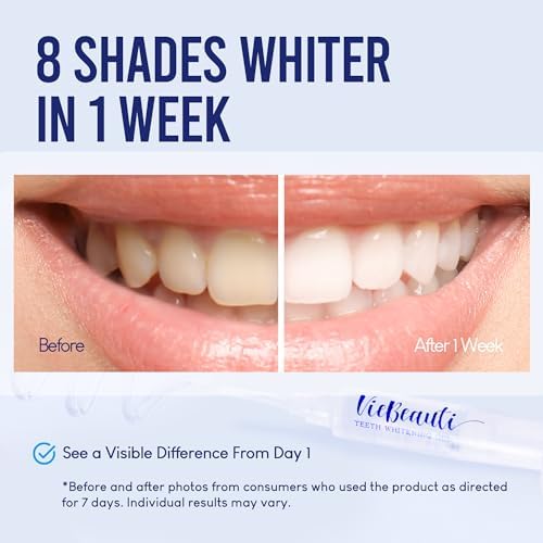 Kit de Blanqueamiento Dental VieBeauti con Luz LED para Dientes Sensibles, 35% Peróxido de Carbamida, Gel Remineralizante Sabor Menta Fresca - imagen 2