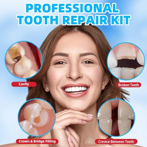 Kit de Reparación Dental con Cemento de Óxido de Zinc y Eugenol, Rellenos Temporales para Dientes Astillados, Coronas Sueltas y Cavidades - imagen 2