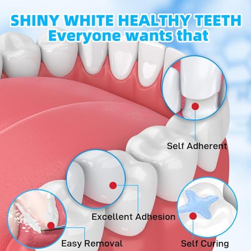 Kit de Reparación Dental con Cemento de Óxido de Zinc y Eugenol, Rellenos Temporales para Dientes Astillados, Coronas Sueltas y Cavidades - imagen 5