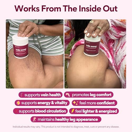 VoomVaya Vein Away – Suplementos para la Circulación y Soporte Venoso para Mujeres 35+ | Tratamiento para Venas Varicosas y Arañitas | 60 Cápsulas - imagen 3