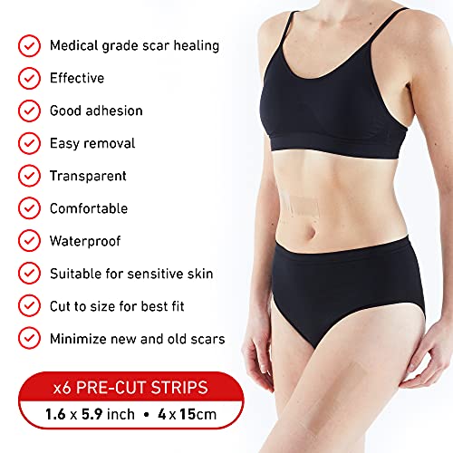 Tiras de Silicona Neo G Opti-Heal para Recuperación de Heridas, Tratamiento de Cicatrices Quirúrgicas, Césarea, Quemaduras y Acné - 1.6 x 5.9 - imagen 2