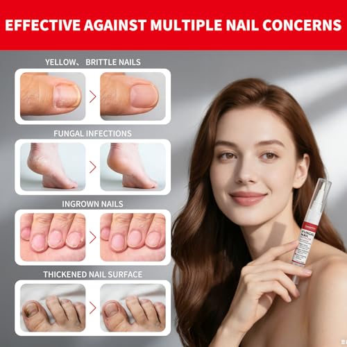 Tratamiento para Hongos en Uñas con Puntero Extra Fuerte, Reparador de Uñas Dañadas, Amarillas y Encarnadas, con Aceite de Árbol de Té, 3 Plumas - imagen 6