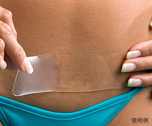 Tiras de Gel de Silicona Epiderm - Cinta de Silicona para Cuidado de Cicatrices - Cinta para Cesárea, Abdominoplastia y Cirugías Cardíacas - Flexible - imagen 1