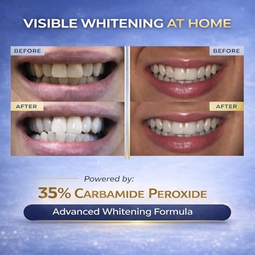 Pack de Recarga de Gel Blanqueador de Dientes Avanzado – 60 Tratamientos | Gel Profesional de 35% Peróxido de Carbamida | 3×10 mL Jeringas | Pasta de - imagen 4