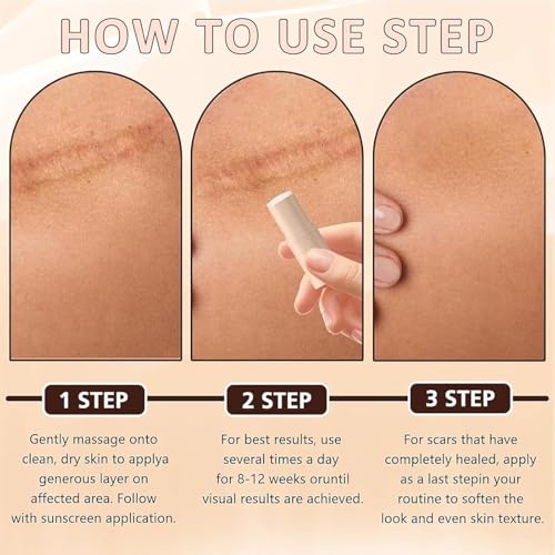 Stick de Silicona para Cicatrices, Mejora la Apariencia de Cicatrices en Cara y Cuerpo, Ideal Después de Cirugías, Acné, Quemaduras y Cortes (Paquete - imagen 7