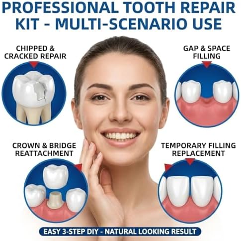 Kit de Reparación Dental con Cemento de Óxido de Zinc y Eugenol, Reemplazo Temporal de Dientes, 2 Piezas para Dientes Rotos y Puentes - imagen 3