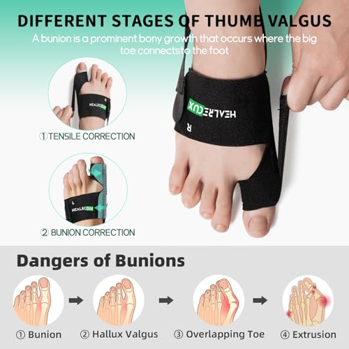 Corrector de Juanetes Healrecux para Mujeres y Hombres, Férula para Hallux Valgus, Enderezador de Dedo Gordo para Uso Diario, 1 Par - imagen 5