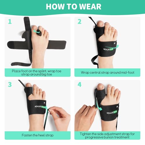 Corrector de Juanetes Healrecux para Mujeres y Hombres, Férula para Hallux Valgus, Enderezador de Dedo Gordo para Uso Diario, 1 Par - imagen 8