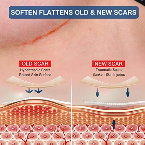 Hojas de Silicona para Cicatrices en Senos - Paquete de 8, Incluye 4 Tiras Suaves para Areolas y 4 Hojas Ancla - imagen 2