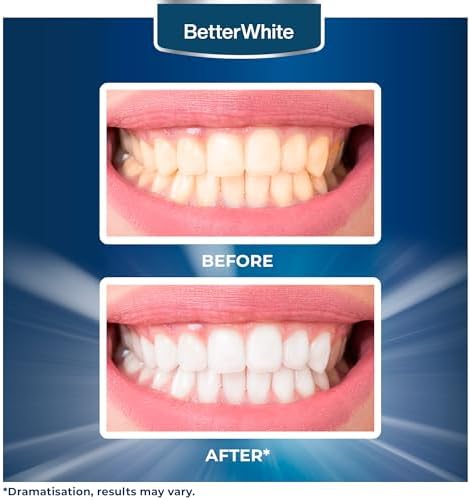 Polvo Blanqueador de Dientes BetterWhite - Fórmula No Sensible con Hidroxiapatita, Remineralizante - Aprobado por Dentistas, Sin Flúor (30 Gramos) - imagen 6