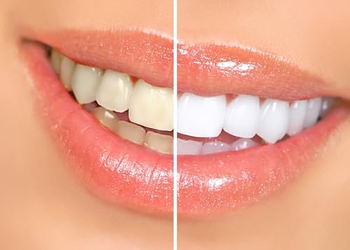 Gel Blanqueador Dental Dr. George con Instrucciones - imagen 5