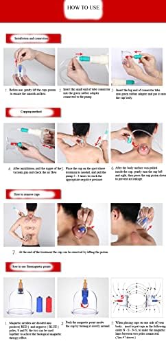 Set de Terapia de Ventosas Biomagnéticas Kangzhu de 24 Tazas - imagen 5