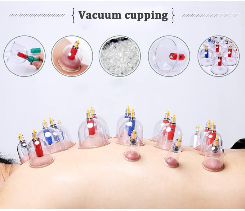 Set de Terapia de Ventosas Biomagnéticas Kangzhu de 24 Tazas - imagen 8