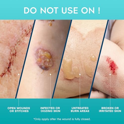 Gel Aroamas para Cicatrices Avanzadas - Gel de Silicona Médica para Mejorar la Apariencia de Cicatrices y Estrías en Cara y Cuerpo - 45g - imagen 7