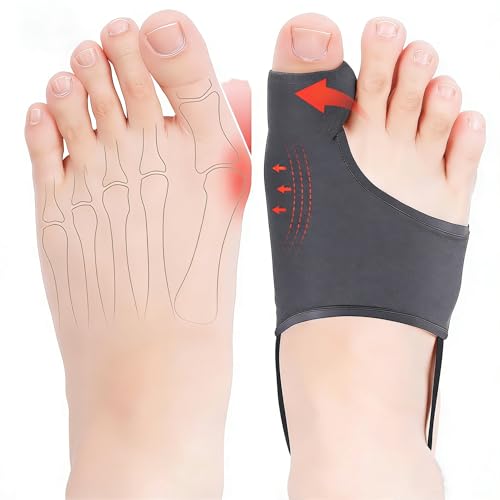Corrector de Juanetes QCCL 2 Piezas para Mujeres y Hombres con Splint y Almohadillas para Alivio del Dolor de Hallux Valgus y Enderezador de Dedo - imagen 1