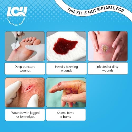 Kit de 43 Piezas para Cierre de Heridas - Bandas Mariposa, 4 Tipos - Vendajes de Sutura, Gasas, Apósitos de PU, Alcohol y Hisopos - Kit de Emergencia - imagen 6