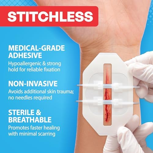 Kit de 43 Piezas para Cierre de Heridas - Bandas Mariposa, 4 Tipos - Vendajes de Sutura, Gasas, Apósitos de PU, Alcohol y Hisopos - Kit de Emergencia - imagen 8