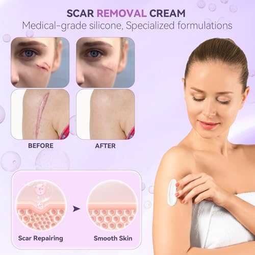 Crema Avanzada para Cicatrices, Gel de Silicona para Cicatrices Nuevas y Viejas, Eliminación de Cicatrices Quirúrgicas, Estrías, C-Section, Keloides, - imagen 3