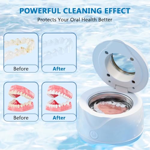 Limpiador Ultrasónico Hoffeins para Retenedores 45kHz 200ml, Máquina Portátil para Retenedores Dentales, Protectores Bucales, Alineadores y Joyería - imagen 5
