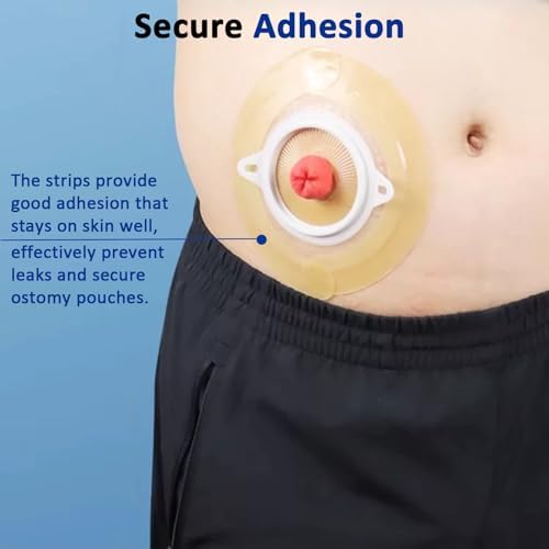 30 Piezas de Tiras Barrera para Ostomía, Suministros Médicos Hidrocoloides, Tiras Elásticas Impermeables para Bolsas de Colostomía - imagen 2