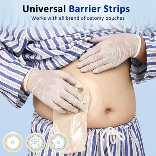 30 Piezas de Tiras Barrera para Ostomía, Suministros Médicos Hidrocoloides, Tiras Elásticas Impermeables para Bolsas de Colostomía - imagen 6