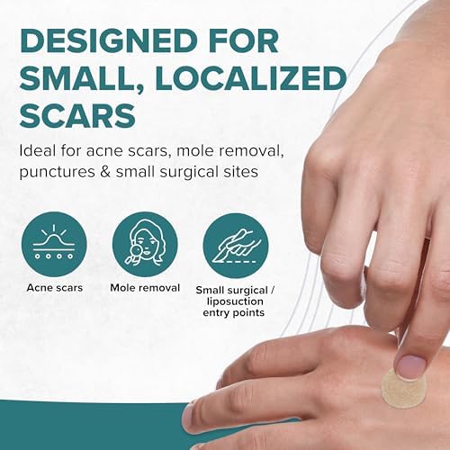 Círculos de Silicona Epiderm para Cicatrices – Parches Reutilizables para Cara y Cuerpo – Dots Adhesivos para Cicatrices Queloides, Quirúrgicas y de - imagen 2