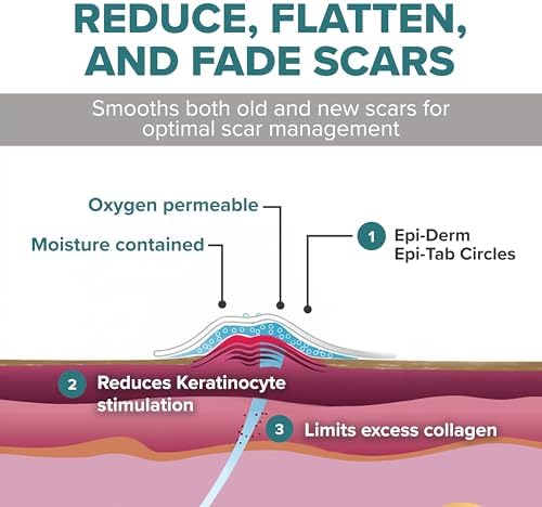 Círculos de Silicona Epiderm para Cicatrices – Parches Reutilizables para Cara y Cuerpo – Dots Adhesivos para Cicatrices Queloides, Quirúrgicas y de - imagen 4