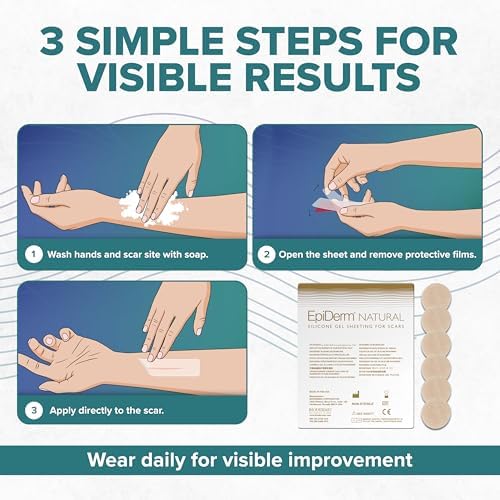 Círculos de Silicona Epiderm para Cicatrices – Parches Reutilizables para Cara y Cuerpo – Dots Adhesivos para Cicatrices Queloides, Quirúrgicas y de - imagen 8