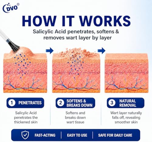 DVO Líquido Removedor de Verrugas con 20% de Ácido Salicílico, Máxima Potencia, Rápido y Sin Dolor, 30ML, para Hombres y Mujeres - imagen 3