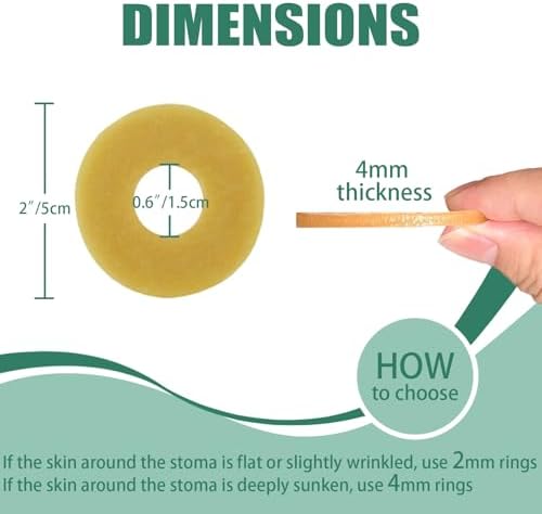 30 Piezas de Anillos de Barrera Ostomía de 4mm, Cinta Hidrocoloide Elástica, Sellos Cohesivos, Extensores de Piel para Bolsas de Colostomía, - imagen 5
