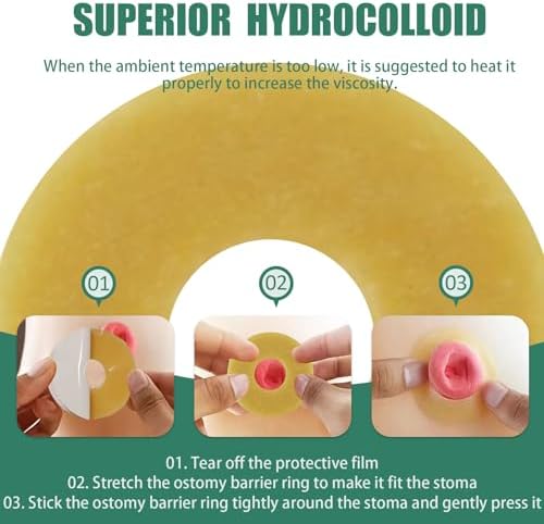 30 Piezas de Anillos de Barrera Ostomía de 4mm, Cinta Hidrocoloide Elástica, Sellos Cohesivos, Extensores de Piel para Bolsas de Colostomía, - imagen 6