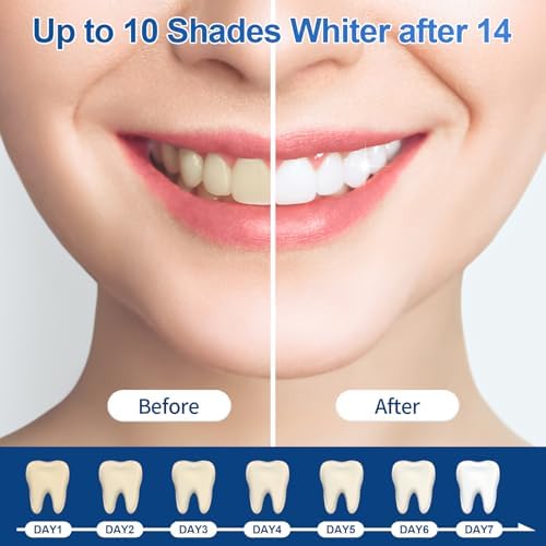 Recargas de Gel Blanqueador Dental 44% Ganencsnc - 10 Jeringas (3ml) - Fórmula Fuerte de Peróxido de Carbamida - Compatible con Kit de Blanqueamiento - imagen 5