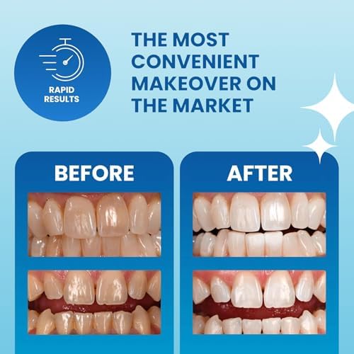Tiras Blanqueadoras de Dientes POOOF! Dr. Bill Dorfman, 12% Peróxido de Hidrógeno, Seguras para el Esmalte, Sin Sensibilidad, Sabor Menta | 10 Días, - imagen 6